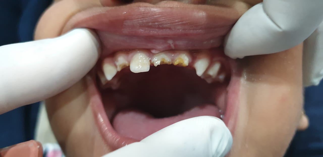 Best dentist nearby me