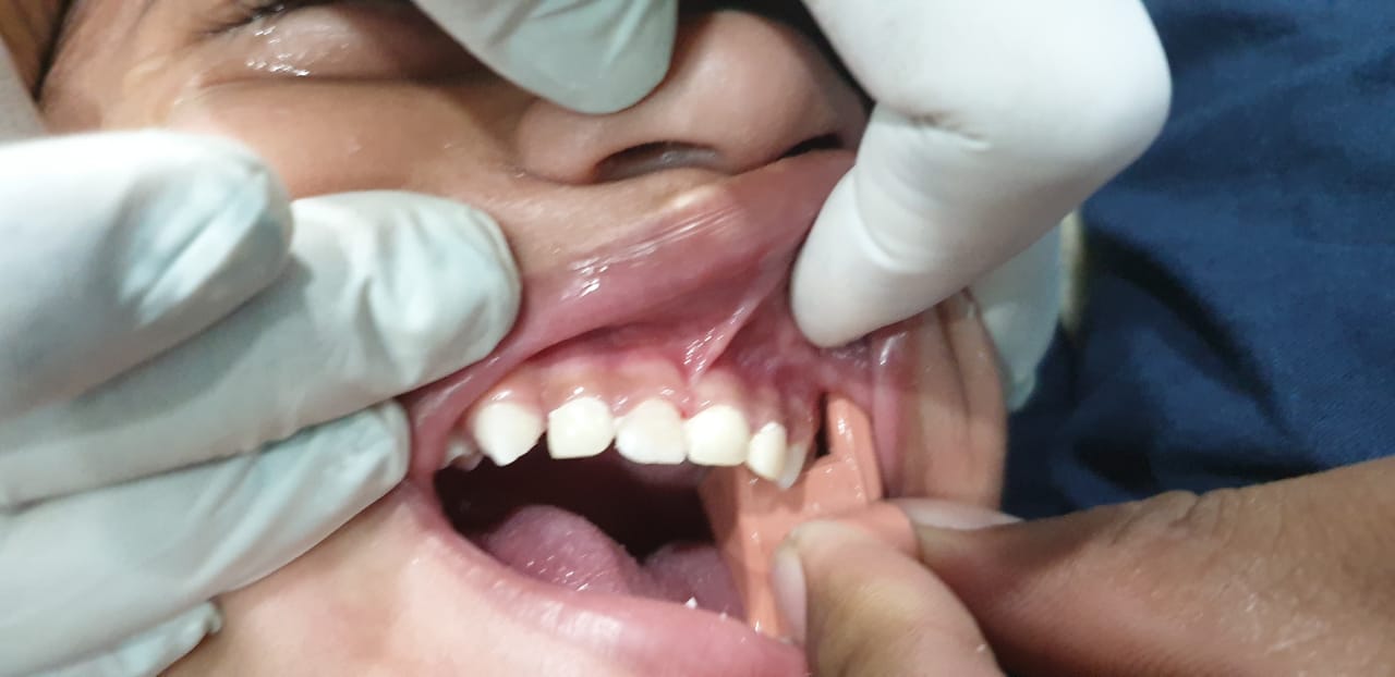 Kids dentist near me