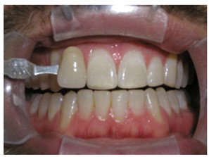 laser Dentist near me